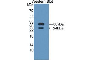Western blot analysis of recombinant Human BMX. (BMX 抗体  (AA 287-523))