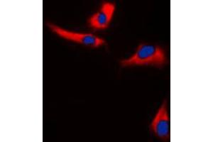 Immunofluorescent analysis of EPS8L3 staining in U251MG cells.