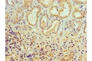 Immunohistochemistry of paraffin-embedded human kidney tissue using ABIN7150218 at dilution of 1:100 (ALKBH2 抗体  (AA 1-261))