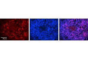 Rabbit Anti-PAntibody   Formalin Fixed Paraffin Embedded Tissue: Human Lymph Node Tissue Observed Staining: Nucleus Primary Antibody Concentration: 1:100 Other Working Concentrations: N/A Secondary Antibody: Donkey anti-Rabbit-Cy3 Secondary Antibody Concentration: 1:200 Magnification: 20X Exposure Time: 0. (PARP1 抗体  (C-Term))