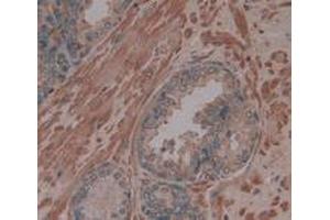 IHC-P analysis of Human Prostate Gland Tissue, with DAB staining. (Procollagen Type I Propeptide 抗体  (N-Term))