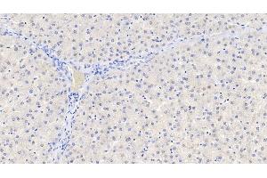 Detection of GDNF in Human Liver Tissue using Polyclonal Antibody to Glial Cell Line Derived Neurotrophic Factor (GDNF) (GDNF 抗体  (AA 78-211))