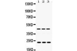 Western Blotting (WB) image for anti-RAB13, Member RAS Oncogene Family (RAB13) (AA 121-150), (C-Term) antibody (ABIN3043916) (RAB13 抗体  (C-Term))