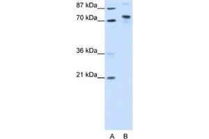 Western Blotting (WB) image for anti-TOX High Mobility Group Box Family Member 4 (TOX4) antibody (ABIN2461858) (TOX4 抗体)