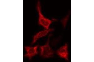 ABIN6277758 staining Hela cells by IF/ICC.