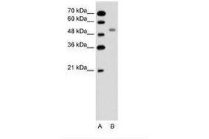 Image no. 2 for anti-Solute Carrier Family 12 (Sodium/potassium/chloride Transporters), Member 1 (SLC12A1) (AA 351-400) antibody (ABIN6736611) (SLC12A1 抗体  (AA 351-400))