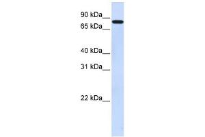 WB Suggested Anti-ZNF287 Antibody Titration:  0. (ZNF287 抗体  (N-Term))