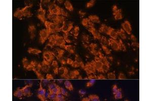 Immunofluorescence analysis of C6 cells using LRRC7 Polyclonal Antibody at dilution of 1:100. (LRRC7 抗体)