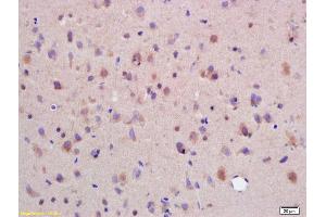 Formalin-fixed and paraffin embedded rat brain labeled with Rabbit Anti SYTL5/slp5 Polyclonal Antibody, Unconjugated (ABIN754498) at 1:200 followed by conjugation to the secondary antibody and DAB staining (SYTL5 抗体  (AA 801-921))