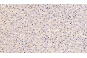 Detection of APOE in Rat Liver Tissue using Polyclonal Antibody to Apolipoprotein E (APOE) (APOE 抗体  (AA 19-168))