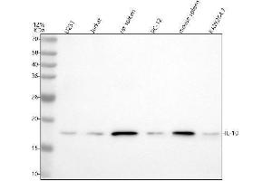 Western blot analysis of IL10 using anti-IL10 antibody (ABIN7605245).