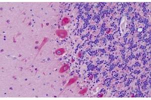 anti-Ephrin A1 (EFNA1) (AA 66-115) antibody