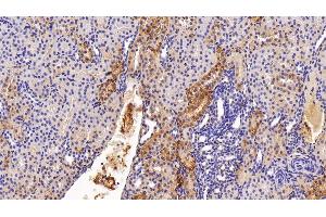 Immunohistochemistry (IHC) image for anti-Ferritin, Heavy Polypeptide 1 (FTH1) (AA 1-183) antibody (ABIN7435313)