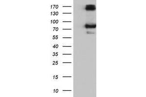 Western Blotting (WB) image for anti-Calpain 9 (CAPN9) antibody (ABIN1497090) (Calpain 9 抗体)