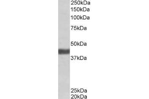 ABIN570946 (1 µg/mL) staining of Human Skeletal Muscle lysate (35 µg protein in RIPA buffer). (FBXO32 抗体  (Internal Region))