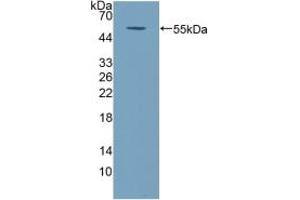 Detection of Recombinant COQ6, Human using Polyclonal Antibody to Coenzyme Q6 Homolog, Monooxygenase (COQ6) (COQ6 抗体  (AA 1-468))