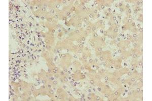 Immunohistochemistry of paraffin-embedded human liver tissue using ABIN7149960 at dilution of 1:100 (FMO4 抗体  (AA 1-300))