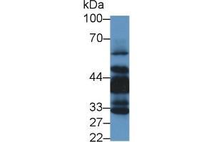 Western Blot; Sample: Human Lung lysate; Primary Ab: 1µg/ml Rabbit Anti-Human LIMS1 Antibody Second Ab: 0. (LIMS1 抗体  (AA 68-303))
