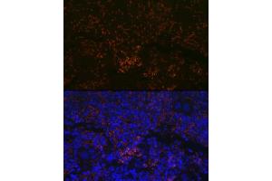 Immunofluorescence analysis of mouse spleen using CXCR3 Rabbit mAb (ABIN7266318) at dilution of 1:100 (40x lens). (CXCR3 抗体)