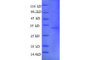SDS-PAGE (SDS) image for Metallothionein 1A (MT1A) (AA 1-59), (partial) protein (GST tag) (ABIN5713090) (MT1A Protein (AA 1-59, partial) (GST tag))