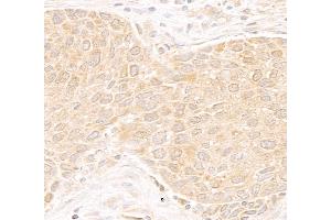 Immunohistochemistry (IHC) image for anti-DEAD (Asp-Glu-Ala-As) Box Polypeptide 19B (DDX19B) (C-Term) antibody (ABIN7453856) (DDX19B 抗体  (C-Term))