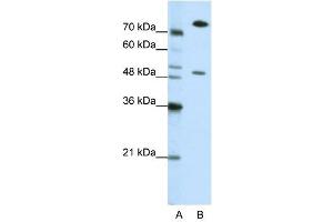 SSB antibody used at 0. (SSB 抗体)