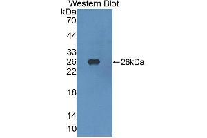 Western blot analysis of the recombinant protein. (FGFR4 抗体  (AA 165-366))
