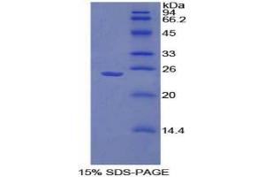 SDS-PAGE analysis of Mouse Sprouty Homolog 1 Protein. (SPRY1 蛋白)