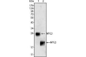 Western blot analysis using MYL3 (1) and MYL2 (2) mouse mAb against rat fetal heart tissue lysate. (MYL2 抗体)