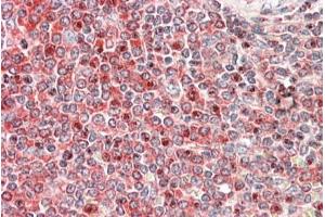 ABIN1590084 (5µg/ml) staining of paraffin embedded Human Spleen. (PKC beta 抗体  (Internal Region))