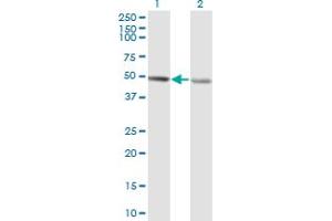 Western Blot analysis of RCC1 expression in transfected 293T cell line by RCC1 monoclonal antibody (M02), clone 1C1. (RCC1 抗体  (AA 312-421))
