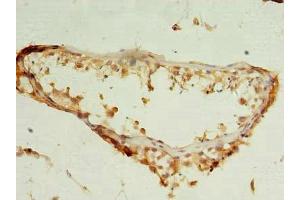 Immunohistochemistry of paraffin-embedded human testis tissue using ABIN7149993 at dilution of 1:100 (NUDT11 抗体  (AA 1-164))