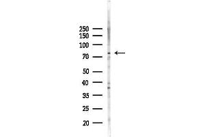 anti-Parathyroid Hormone 1 Receptor (PTH1R) (pThr1) antibody
