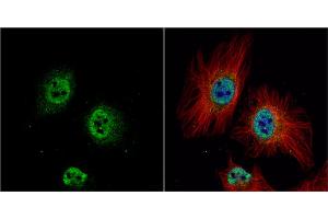 ICC/IF Image ZWINT antibody detects ZWINT protein at nucleus by immunofluorescent analysis. (ZWINT 抗体  (Center))