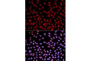 Immunofluorescence analysis of U2OS cells using POLH antibody. (POLH 抗体  (AA 20-320))