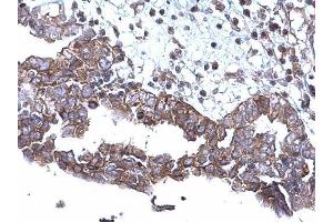 Immunohistochemistry (IHC) image for anti-Sequestosome 1 (SQSTM1) antibody (ABIN2854836)