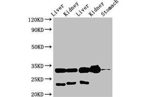 Western Blot Positive WB detected in: Rat liver tissue, Rat kidney tissue, Mouse liver tissue, Mouse kidney tissue, Mouse stomach tissue All lanes: TPSB2 antibody at 3 μg/mL Secondary Goat polyclonal to rabbit IgG at 1/50000 dilution Predicted band size: 31 kDa Observed band size: 31 kDa (TPSB2 抗体  (AA 31-275))