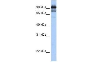 Western Blotting (WB) image for anti-Signal Transducer and Activator of Transcription 6, Interleukin-4 Induced (STAT6) (C-Term) antibody (ABIN927315)