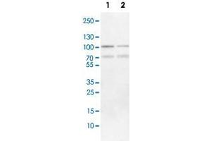 Western Blot analysis of Lane 1: NIH-3T3 cell lysate (mouse embryonic fibroblast cells) and Lane 2: NBT-II cell lysate (Wistar rat bladder tumor cells) with FOXP1 polyclonal antibody . (FOXP1 抗体)