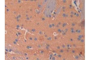 Used in DAB staining on fromalin fixed paraffin- embedded kidney tissue (BMP5 抗体  (AA 201-314))