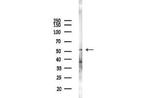 Western blot analysis of lysates from 293 cells(UV,30 min treatment), using PPP2R3C Antibody at 1/1000 dilution.