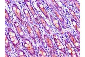 Immunohistochemistry of paraffin-embedded human small intestine tissue using ABIN7151743 at dilution of 1:100 (LIPG 抗体  (AA 360-500))