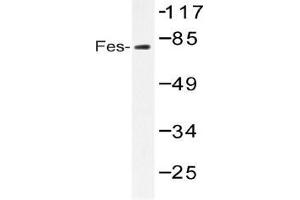 Western blot (WB) analysis of Fes antibody in extracts from HUVEC serum 20 (FES 抗体)