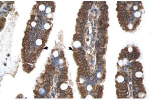 Human Intestine (PGRMC1 抗体  (N-Term))
