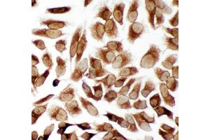 Anti-TRAM1 antibody, ICC ICC: HELA Cell (TRAM1 抗体  (C-Term))