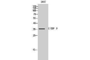 Western Blotting (WB) image for anti-CCAAT/enhancer Binding Protein (C/EBP), beta (CEBPB) (C-Term) antibody (ABIN3174088) (CEBPB 抗体  (C-Term))