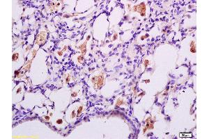 Formalin-fixed and paraffin embedded rat lung tissue labeled with Anti phospho-IFNAR1(Ser535+Ser539) Polyclonal Antibody,Unconjugated (ABIN802353) at 1:200 followed by conjugation to the secondary antibody and DAB staining. (IFNAR1 抗体  (pSer535, pSer538))