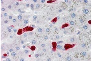 Human Liver, Hepatocytes and Macrophages (formalin-fixed, paraffin-embedded) stained with S100A8 antibody ABIN334264 at 5 ug/ml followed by biotinylated anti-mouse IgG secondary antibody ABIN481714, alkaline phosphatase-streptavidin and chromogen. (S100A8 抗体)