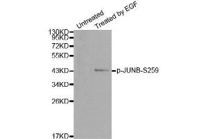 Western blot analysis of extracts from HT29 cells, using Phospho-JUNB-S259 antibody. (JunB 抗体  (pSer259))
