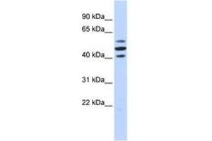 Image no. 1 for anti-HSPB (Heat Shock 27kDa) Associated Protein 1 (HSPBAP1) (AA 180-229) antibody (ABIN6742394) (HSPBAP1 抗体  (AA 180-229))